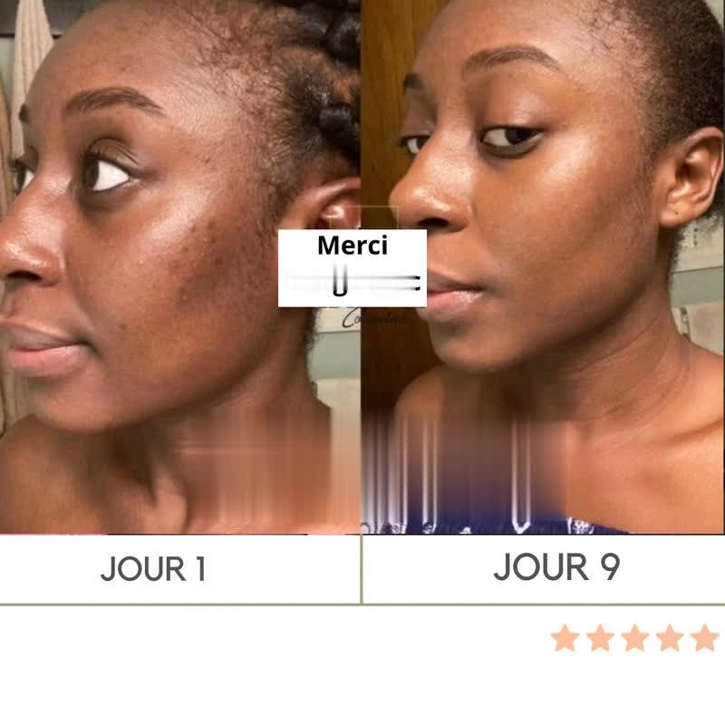 Transformez votre sommeil en rituel de jeunesse et réveillez-vous avec une peau sublime chaque matin